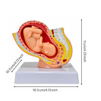 Uterus Model with Fetus Mounted Structural Gestation Model Realistic for Teachers