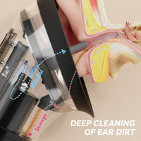 Electric Ear Cerumen Remover Handheld for Travel
