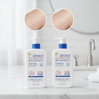 Vitamin E Urea Body Lotion for Dry, Cracked, Rough Skin - Moisturizing & Hydrating Cream