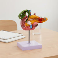 Digestive System Pathology Model Display Pancreas Duodenum Gallbladder Model PVC Material Teaching Aid for Physician's Office
