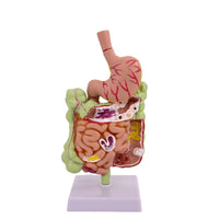 Large Intestine Model with Stomach Structural Digestive System Model with Colon Teaching for Doctors