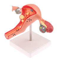 Uterus Ovary Structural Model Transparent Stand Educational Aid Tabletop Display for Classroom