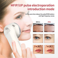 EMS Hot & Cold Facial Massager for Skin Rejuvenation and Lifting