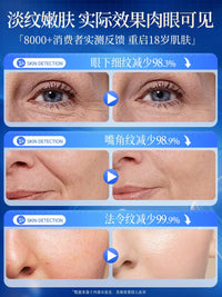 Anti-Wrinkle Patches for Forehead and Face - Lift, Firm, and Reduce Fine Lines During Sleep