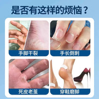 Autumn and Winter Dry Cracked Hand and Foot Tape, Breathable High-Viscosity Pressure-Sensitive Tape for Finger Cracks and Fissures