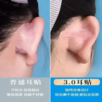 Elf Ear Corrector and Support Patches for Prominent Ears - Silicone Fixation for Photography & Daily Wear