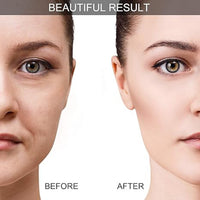 Silicone Facial Cupping Set for Anti-Aging and Skin Rejuvenation