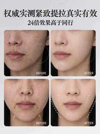 V-Face Massager for Face Lifting, Tightening, and Double Chin Reduction