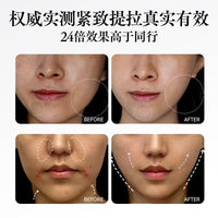 V-Face Beauty Device Red Blue Light Therapy for Face Lifting and Tightening