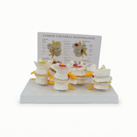 Diseased Spine Comparison Model Medical Spine Model with Card Educational for Teachers, Students, Musculoskeletal Teaching, Practice Setting Display