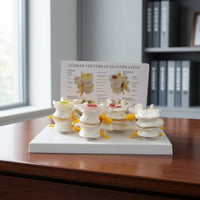 Diseased Spine Comparison Model Medical Spine Model with Card Educational for Teachers, Students, Musculoskeletal Teaching, Practice Setting Display