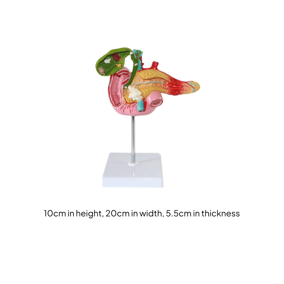 Pancreas Pathology Model Gallbladder Pathology Model Gallstones