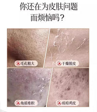 Rubber Body Scrubber Disc with Five-Finger Design for Bathing