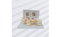 Diseased Spine Comparison Model Medical Spine Model with Card Educational for Teachers, Students, Musculoskeletal Teaching, Practice Setting Display